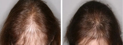 Sérum croissance capillaire