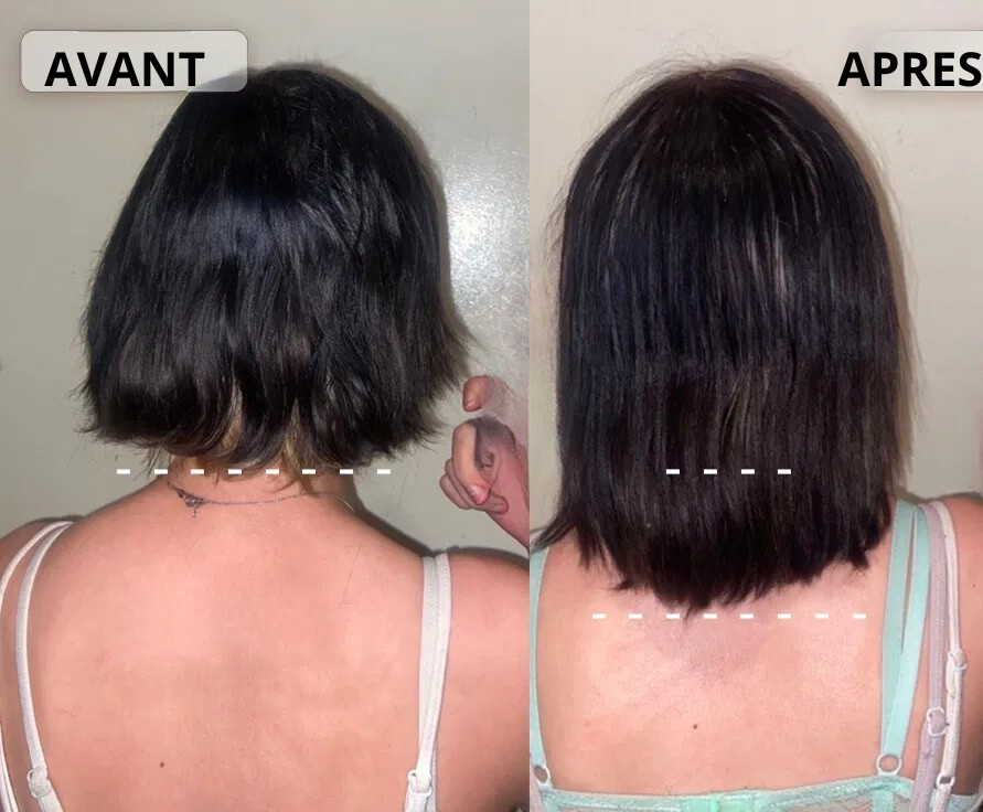 Sérum croissance capillaire