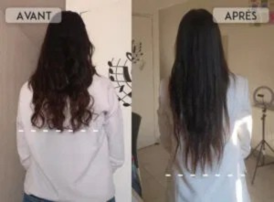 Sérum croissance capillaire